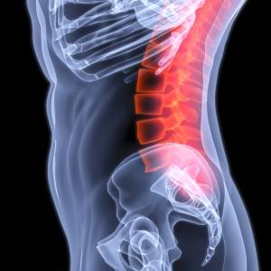 Spinal Cord Injury Lawyer